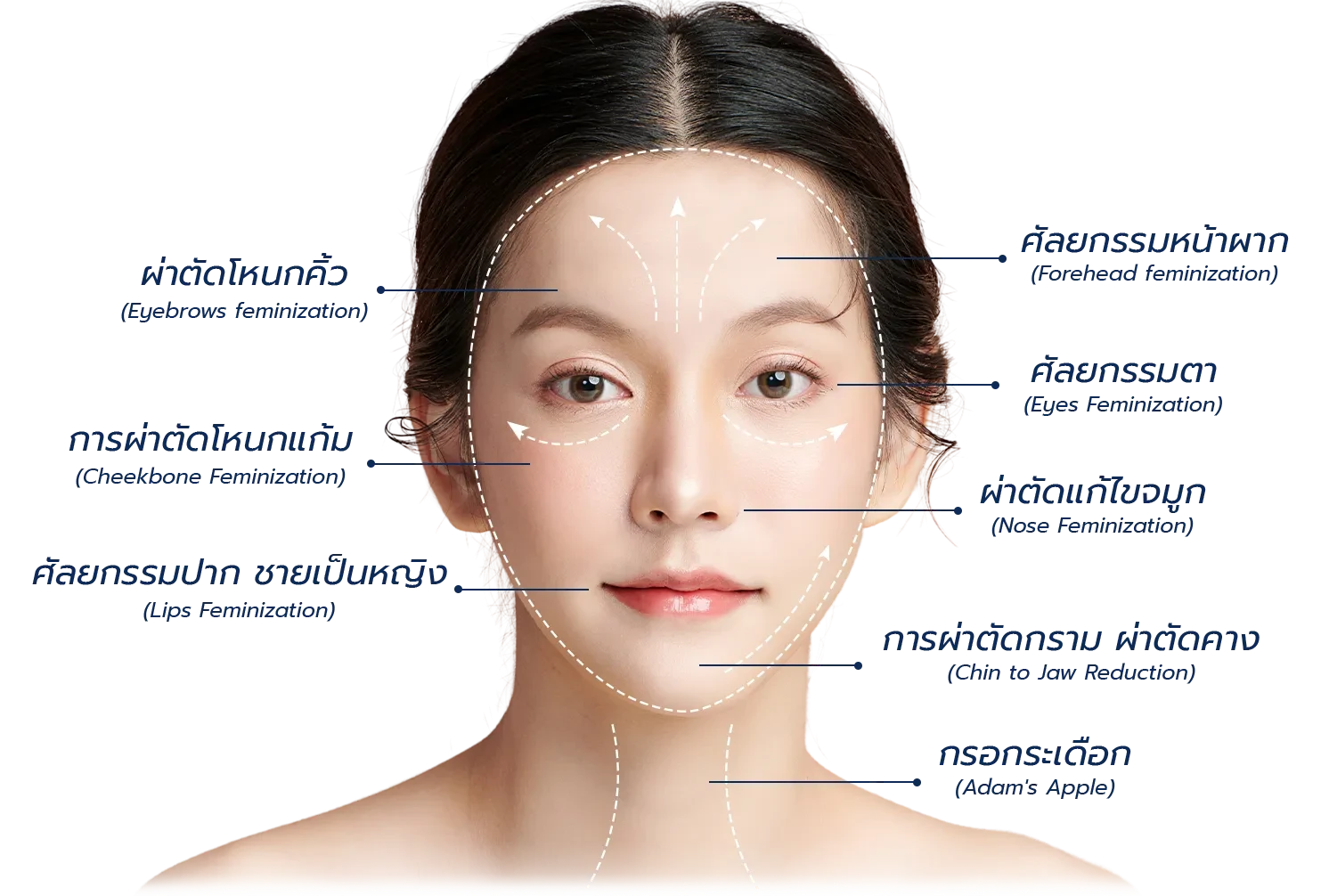 Facial Feminization Surgery Cost Thailand - โรงพยาบาลศัลยกรรมตกแต่งมิลาด้า